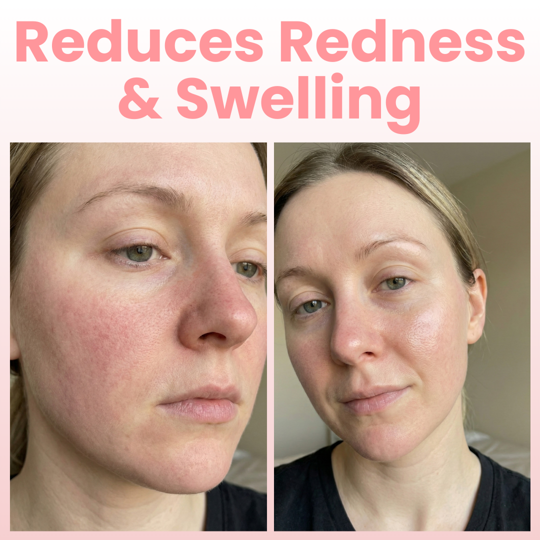 PDRN Pink Collagen Gel Mask